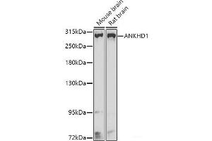 Western blot analysis of extracts of various cell lines using ANKHD1 Polyclonal Antibody at dilution of 1:1000. (ANKHD1 anticorps)
