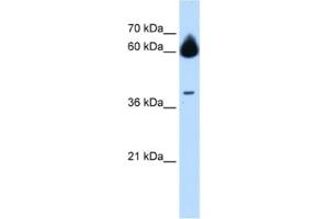 Western Blotting (WB) image for anti-Matrix Metallopeptidase 23B (MMP23B) antibody (ABIN2463013)