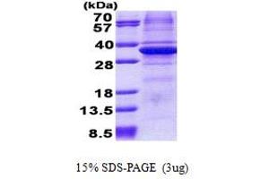 SDS-PAGE (SDS) image for Carbonic Anhydrase XI (CA11) (AA 24-328) protein (His tag) (ABIN5853103)