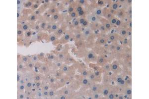Used in DAB staining on fromalin fixed paraffin- embedded Kidney tissue