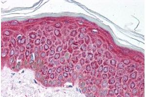 Human Skin (formalin-fixed, paraffin-embedded) stained with ETV4 antibody ABIN214103 at 5 ug/ml followed by biotinylated goat anti-rabbit IgG secondary antibody ABIN481713, alkaline phosphatase-streptavidin and chromogen.