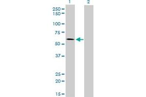 Western Blot analysis of ALPPL2 expression in transfected 293T cell line by ALPPL2 monoclonal antibody (M07), clone 2B3.