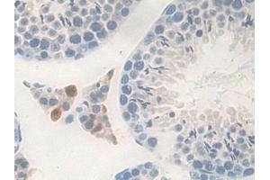 Detection of CPB1 in Mouse Testis Tissue using Polyclonal Antibody to Carboxypeptidase B1, Tissue (CPB1) (CPB1 anticorps  (AA 109-415))