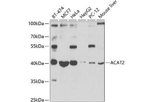 Western blot analysis of extracts of various cell lines, using  antibody (ABIN6131166, ABIN6136417, ABIN6136418 and ABIN6223845) at 1:1000 dilution. (ACAT2 anticorps  (AA 1-97))