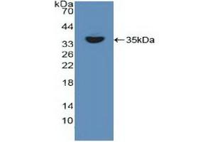 Detection of Recombinant RELB, Human using Polyclonal Antibody to V-Rel Reticuloendotheliosis Viral Oncogene Homolog B (RELB)