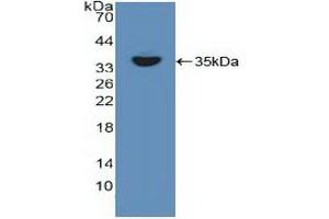 Detection of Recombinant RELB, Human using Polyclonal Antibody to V-Rel Reticuloendotheliosis Viral Oncogene Homolog B (RELB) (RELB anticorps  (AA 248-492))