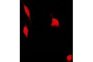 Immunofluorescent analysis of PSMA4 staining in U2OS cells. (PSMA4 anticorps)