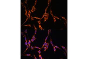Immunofluorescence analysis of NIH/3T3 cells using KRAS antibody (ABIN3021676, ABIN3021677, ABIN3021678, ABIN1513137 and ABIN1514282) at dilution of 1:100. (K-RAS anticorps)