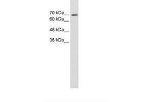 anti-EPS8-Like 1 (EPS8L1) (AA 51-100) antibody