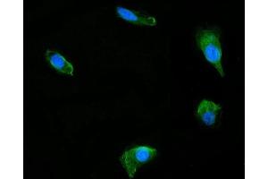 IF analysis of DUSP6 using anti-DUSP6 antibody (ABIN7599332). (DUSP6 anticorps  (AA 1-381))