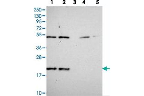 KIAA1143 anticorps