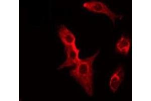 ABIN6275515 staining HeLa by IF/ICC. (SFRP2 anticorps  (Internal Region))