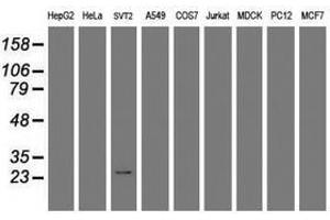Image no. 1 for anti-Regulator of G-Protein Signaling 16 (RGS16) antibody (ABIN1500688) (RGS16 anticorps)