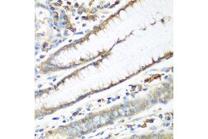 Immunohistochemistry of paraffin-embedded human stomach using CAD antibody at dilution of 1:100 (40x lens). (CAD anticorps)