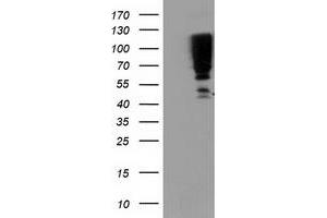 Western Blotting (WB) image for anti-serpin Peptidase Inhibitor, Clade B (Ovalbumin), Member 13 (SERPINB13) antibody (ABIN1500880) (SERPINB13 anticorps)