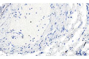 ABIN185271 Negative Control showing staining of paraffin embedded Human Lung, with no primary antibody. (Smooth Muscle Actin anticorps  (N-Term))