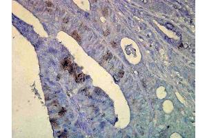 Immunohistochemistry analysis using Mouse Anti-Hsp70 Monoclonal Antibody, Clone C92 .