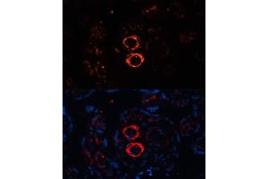 Immunofluorescence analysis of human placenta cells using SMMHC/SMMHC/MYH11 antibody (ABIN6129611, ABIN6144234, ABIN6144235 and ABIN6215005) at dilution of 1:100. (MYH11 anticorps  (AA 1680-1979))