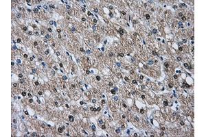 Immunohistochemical staining of paraffin-embedded liver tissue using anti-HSPA1Amouse monoclonal antibody. (HSP70 1A anticorps)