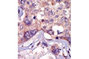 Image no. 2 for anti-Lymphocyte-Specific Protein tyrosine Kinase (LCK) (N-Term) antibody (ABIN359986) (LCK anticorps  (N-Term))