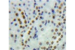 Used in DAB staining on fromalin fixed paraffin-embedded Kidney tissue