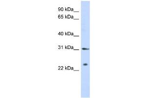 WB Suggested Anti-SSX5 Antibody Titration:  0. (SSX5 anticorps  (Middle Region))