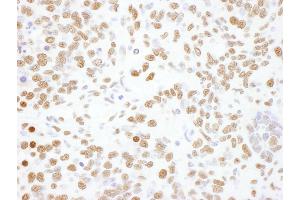 Immunohistochemistry (IHC) image for anti-Heterogeneous Nuclear Ribonucleoprotein L (HNRNPL) (AA 350-400) antibody (ABIN7795591) (HNRNPL anticorps  (AA 350-400))