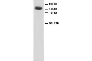 NMDAR1 Polyclonal Antibody (NMDA 1 Receptor anticorps  (N-Term))