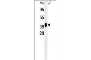 ATG4B/M antibody (ABIN659121 and ABIN2843761) western blot analysis in MCF-7 cell line lysates (35 μg/lane). (ATG4B anticorps)