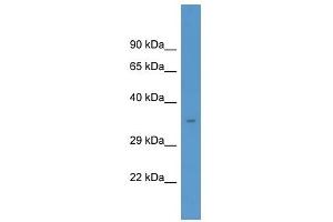 Western Blot showing MARCKS antibody used at a concentration of 1. (MARCKS anticorps  (C-Term))