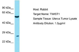 Host: Rabbit Target Name: TWIST1 Sample Tissue: Human Uterus Tumor Antibody Dilution: 1ug/ml (TWIST1 anticorps  (N-Term))