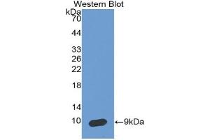 Detection of Recombinant SCCA2, Human using Monoclonal Antibody to Serpin Peptidase Inhibitor,Clade B,Member 4 (SERPINB4) (SERPINB4 anticorps  (AA 144-298))