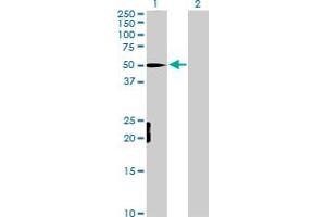 Western Blot analysis of MEF2D expression in transfected 293T cell line by MEF2D MaxPab polyclonal antibody.