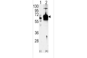 Western blot analysis of GUCY1A3 using GUCY1A3 Antibody using 293 cell lysates (2 ug/lane) either nontransfected (Lane 1) or transiently transfected with the GUCY1A3 gene (Lane 2). (GUCY1A1 anticorps  (N-Term))