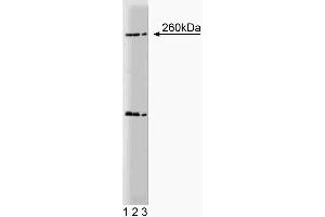 Western blot analysis of Nestin on a rat (E17) cerebrum lysate. (Nestin anticorps  (AA 402-604))