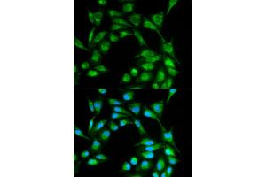 Immunofluorescence analysis of MCF-7 cells using ICOS antibody (ABIN5970917).