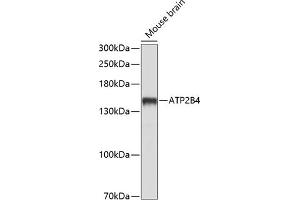 Western blot analysis of extracts of mouse brain, using B4 antibody (ABIN6127393, ABIN6137320, ABIN6137321 and ABIN6214232) at 1:1000 dilution. (ATP2B4 anticorps  (AA 1141-1205))