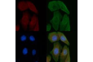 ABIN6261307 and ABIN6277247 staining Hela cells by IF/ICC. (DKK3 anticorps)