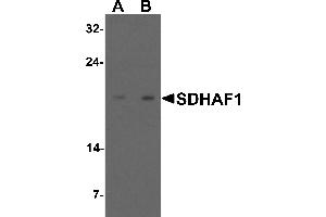 Western blot analysis of SDHAF1 in 3T3 cell lysate with SDHAF1 antibody at (A) 1 and (B) 2 µg/mL. (SDHAF1 anticorps  (C-Term))