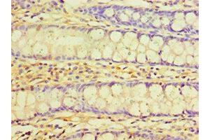 Immunohistochemistry of paraffin-embedded human colon tissue using ABIN7173568 at dilution of 1:100 (TNNC2 anticorps  (AA 1-160))