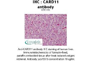 Image no. 1 for anti-Caspase Recruitment Domain Family, Member 11 (CARD11) (AA 18-238) antibody (ABIN1732634)