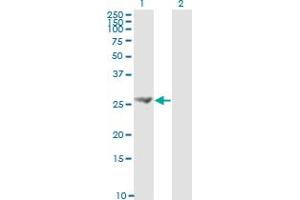 Western Blot analysis of FGF21 expression in transfected 293T cell line by FGF21 monoclonal antibody (M01), clone 2F11.