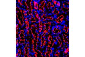 Immunofluorescence of paraffin embedded mouse kidney using eIF5A2 (ABIN7073893) at dilution of 1:300 (400x lens)