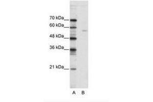 Image no. 1 for anti-ELK1, Member of ETS Oncogene Family (ELK1) (N-Term) antibody (ABIN202499) (ELK1 anticorps  (N-Term))
