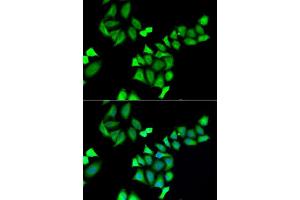 Immunofluorescence analysis of A549 cells using GALE antibody. (GALE anticorps  (AA 129-348))
