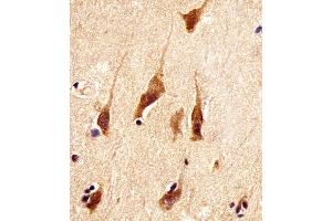 (ABIN6242191 and ABIN6578387) staining ARRB2 in human brain tissue sections by Immunohistochemistry (IHC-P - paraformaldehyde-fixed, paraffin-embedded sections). (Arrestin 3 anticorps  (AA 264-298))