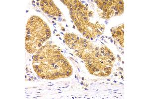 Immunohistochemistry of paraffin-embedded Human gastric using SCO2 antibody at dilution of 1:100 (x400 lens). (SCO2 anticorps)