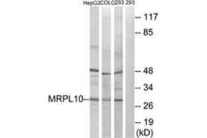 Western blot analysis of extracts from 293/HepG2/COLO cells, using MRPL10 Antibody. (MRPL10 anticorps  (AA 211-260))