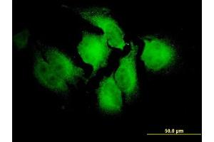 Immunofluorescence of monoclonal antibody to NOTCH2NL on HeLa cell. (NOTCH2NL anticorps  (AA 1-236))