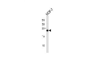 Lane 1: MCF-7 Cell lysates, probed with MGMT (888CT22. (MGMT anticorps)